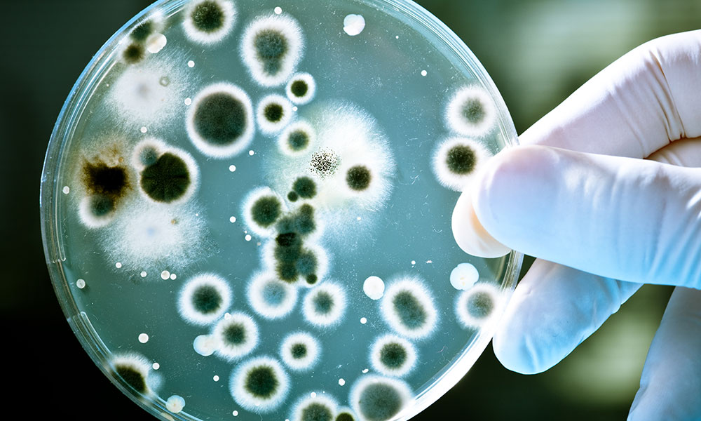 Gloved hand holding a petri dish with bacteria